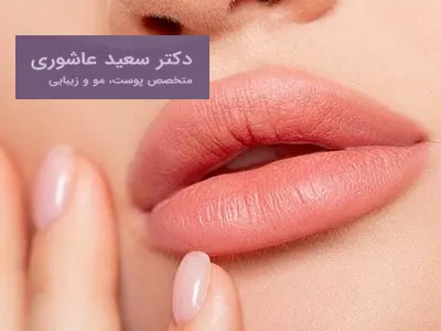 ژل لب طبیعی در اهواز